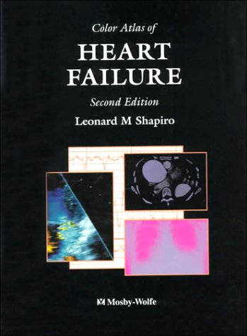 

exclusive-publishers/elsevier/color-atlas-of-heart-failure-2-ed--9780723420231