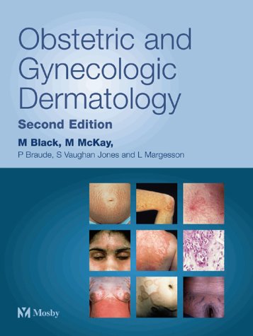 

exclusive-publishers/elsevier/obstetrics-and-gynecologic-dermatology-2ed--9780723431824