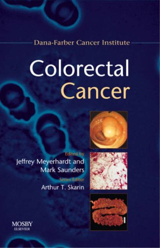 

general-books/general/colorectal-cancer-dana-farber-cancer-institute-handbook-1e-dana-farber--9780723434351