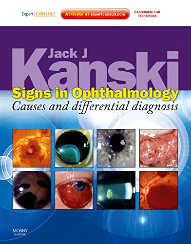 

mbbs/3-year/signs-in-ophthalmology-causes-and-differential-diagnosis-9780723435488