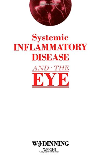 

special-offer/special-offer/systemic-inflammatory-disease-and-the-eye--9780723607779