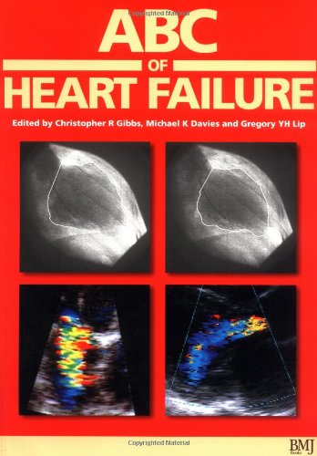 

special-offer/special-offer/abc-of-heart-failure--9780727914576