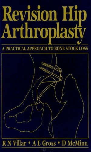 

general-books/general/revision-hip-arthroplasty--9780750616409