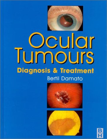 

mbbs/4-year/ocular-tumours-diagnosis-treatment-9780750622202