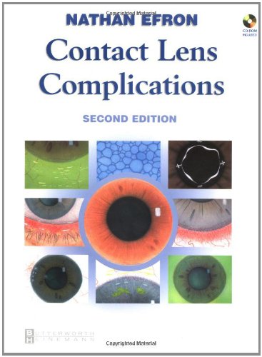 

surgical-sciences/ophthalmology/contact-lens-complications-2-ed-with-cd--9780750655347