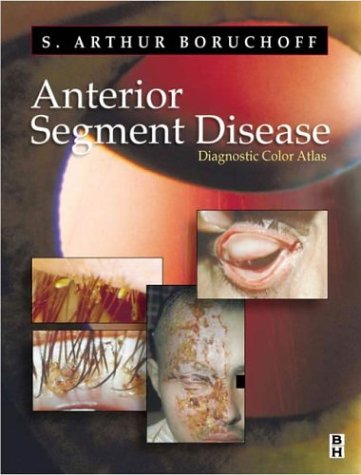 

surgical-sciences/ophthalmology/anterior-segment-disease-a-diagnostic-color-atlas-9780750671811