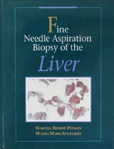 

mbbs/3-year/fine-needle-aspiration-biopsy-of-the-liver-9780750694636