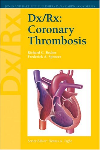 

clinical-sciences/cardiology/dx-rx-coronary-thrombosis-9780763724801