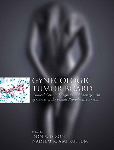 

surgical-sciences/oncology/gynecologic-tumor-board-clinical-cases-in-diag-mana-f-cancer-of-the-9780763743123