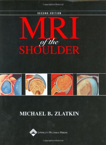 

mbbs/4-year/mri-of-the-shoulder-2-ed-9780781715904