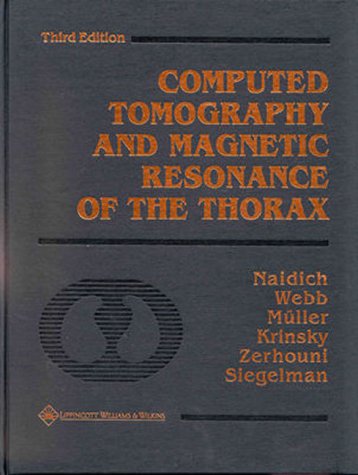 

general-books/general/computed-tomography-and-magnetic-resonance-of-the-thorax--9780781716604