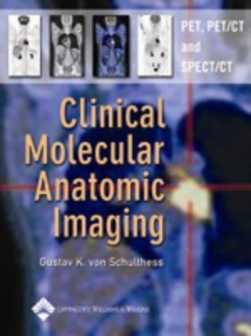 

clinical-sciences/radiology/clinical-molecular-anatomic-imaging-pet-pet-ct-and-spect-ct-9780781741446