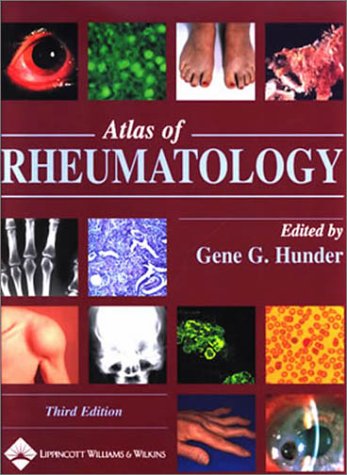 

general-books/general/atlas-of-rheumatology-copublished-with-current-medicine--9780781744423