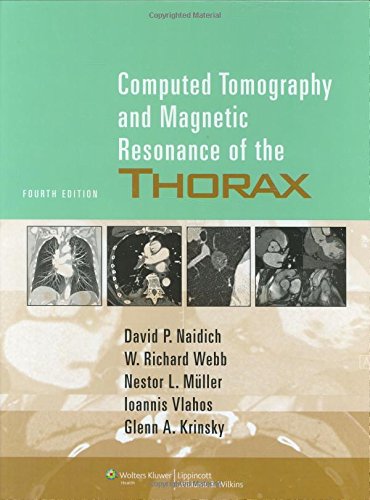 

mbbs/4-year/computed-tomography-and-magnetic-resonance-of-the-thorax-4-ed-9780781757652
