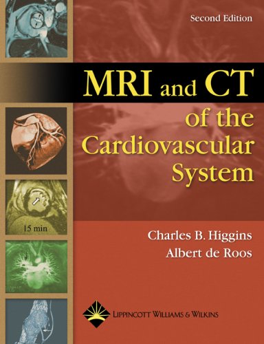 

general-books/general/mri-and-ct-of-the-cardiovascular-system-ex--9780781762717
