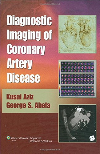 

mbbs/4-year/diagnostic-imaging-of-coronary-artery-disease-9780781766029