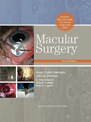 

surgical-sciences/surgery/macular-surgery-9780781797153