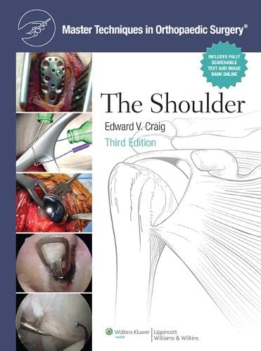 

general-books/general/master-techniques-in-orthopaedic-surgery-the-shoulder-3-ed--9780781797481