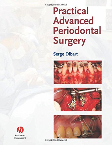 

dental-sciences/dentistry/practical-advanced-periodontal-surgery-1-ed--9780813809571