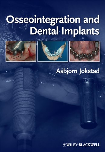 

dental-sciences/dentistry/osseointegration-and-dental-implants--9780813813417