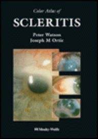 

surgical-sciences/ophthalmology/color-atlas-of-scleritis--9780815191858