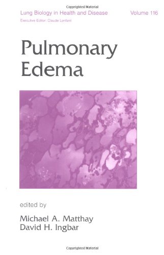 

special-offer/special-offer/lung-biology-in-health-disease-vol-116-pulmonary-edema--9780824701505