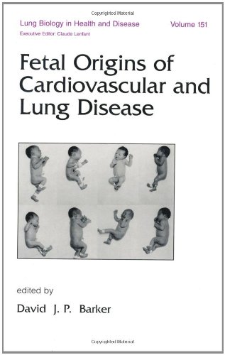 

special-offer/special-offer/lung-biology-in-health-and-disease-vol-151-fetal-origins-of-cardiovascular-and-lung-disease--9780824703912