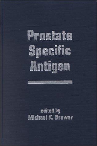 

general-books/general/prostate-specific-antigen--9780824705558