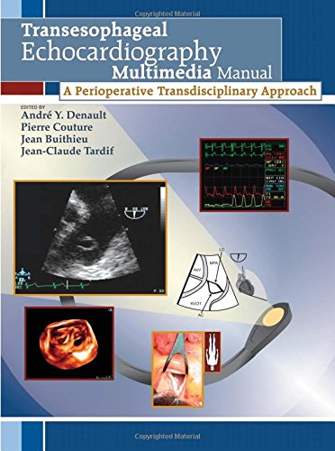 

general-books/general/transesophageal-echocardiography-multimedia-manual--9780824723538