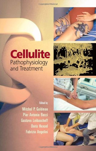 

general-books/general/cellulite-pathophysiology-and-treatment-basic-and-clinical-dermatology--9780824729851