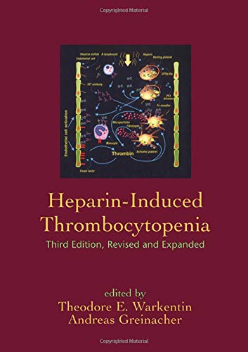 

general-books/general/heparin-induced-thrombocytopenia-3ed--9780824756253