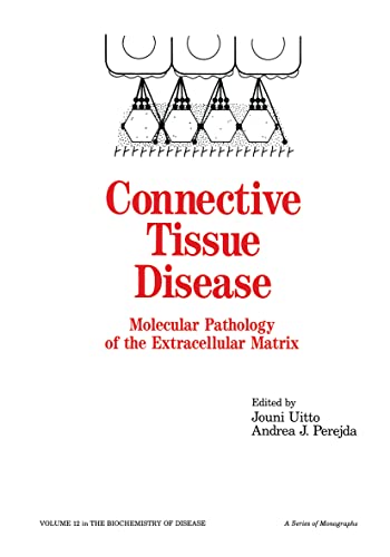 

general-books/general/connective-tissue-disease--9780824775339