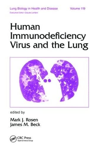 

clinical-sciences/respiratory-medicine/lung-biology-in-health-and-disease-volume-119-human-immunodeficiency-virus-and-the-lung-9780824798833