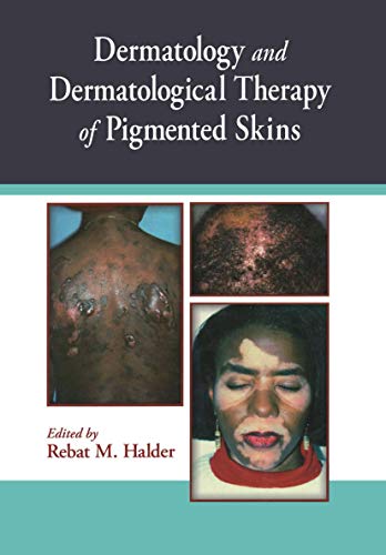 

general-books/general/dermatology-and-dermatological-therapy-of-pigmented-skins--9780849314025