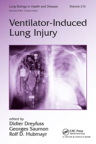 

special-offer/special-offer/lung-biology-in-health-and-disease-vol-215-ventilator-induced-lung-injury--9780849337161
