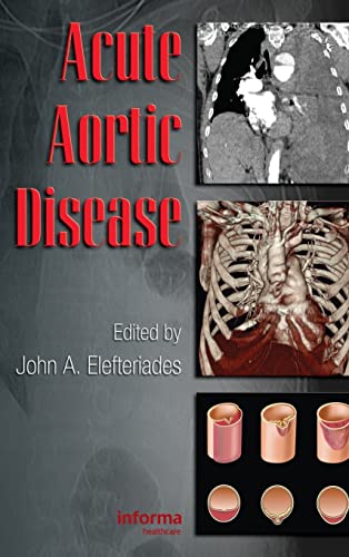 

general-books/general/acute-aortic-diseases-1-ed--9780849370236