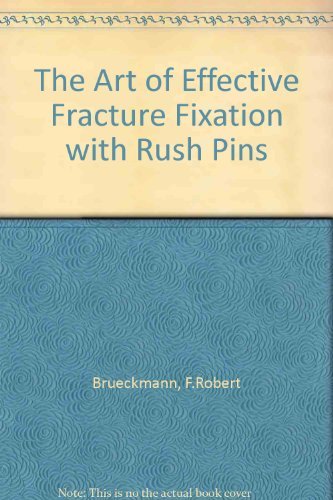 

exclusive-publishers/thieme-medical-publishers/the-art-of-effective-fracture-fixation-with-rush-pins--9780865773233
