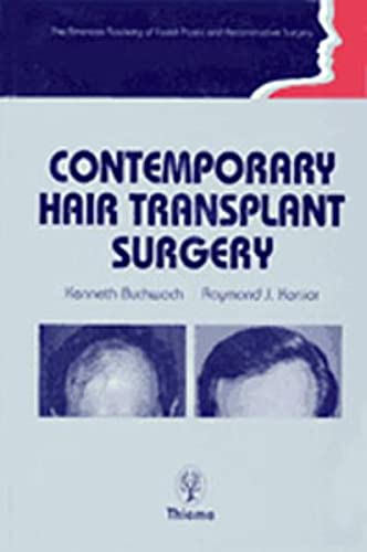 

exclusive-publishers/thieme-medical-publishers/contemporary-hair-transplant-surgery-1-e--9780865775770