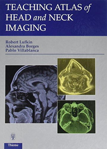 

general-books/general/teaching-atlas-of-head-and-neck-imaging--9780865776913
