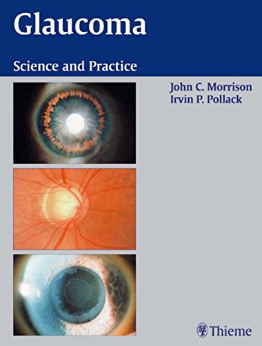 

exclusive-publishers/thieme-medical-publishers/glaucoma-science-and-practice-1-e--9780865779150
