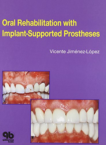 

dental-sciences/dentistry/oral-rehabilitation-with-implant-supported-prostheses-9780867153583
