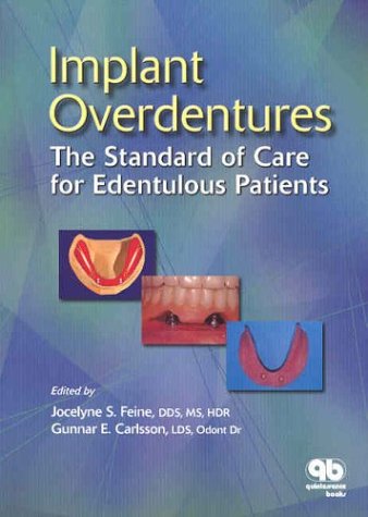

general-books/general/implant-overdentures-the-standard-of-care-for-edentulous-patients--9780867154306