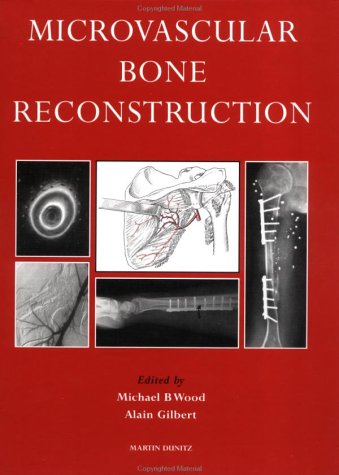 

general-books/general/microvascular-bone-reconstruction--9780948269714