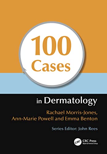 

exclusive-publishers/taylor-and-francis/100-cases-in-dermatology-9781444117936