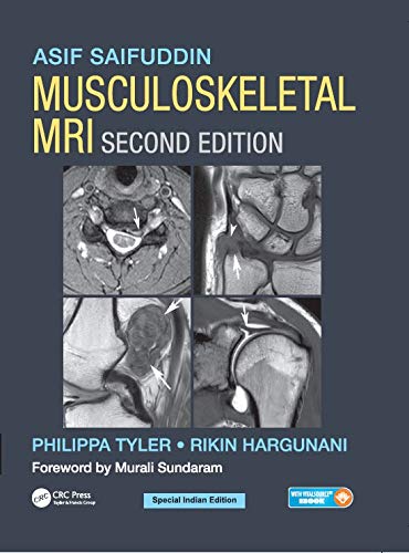 MUSCULOSKELETAL MRI
