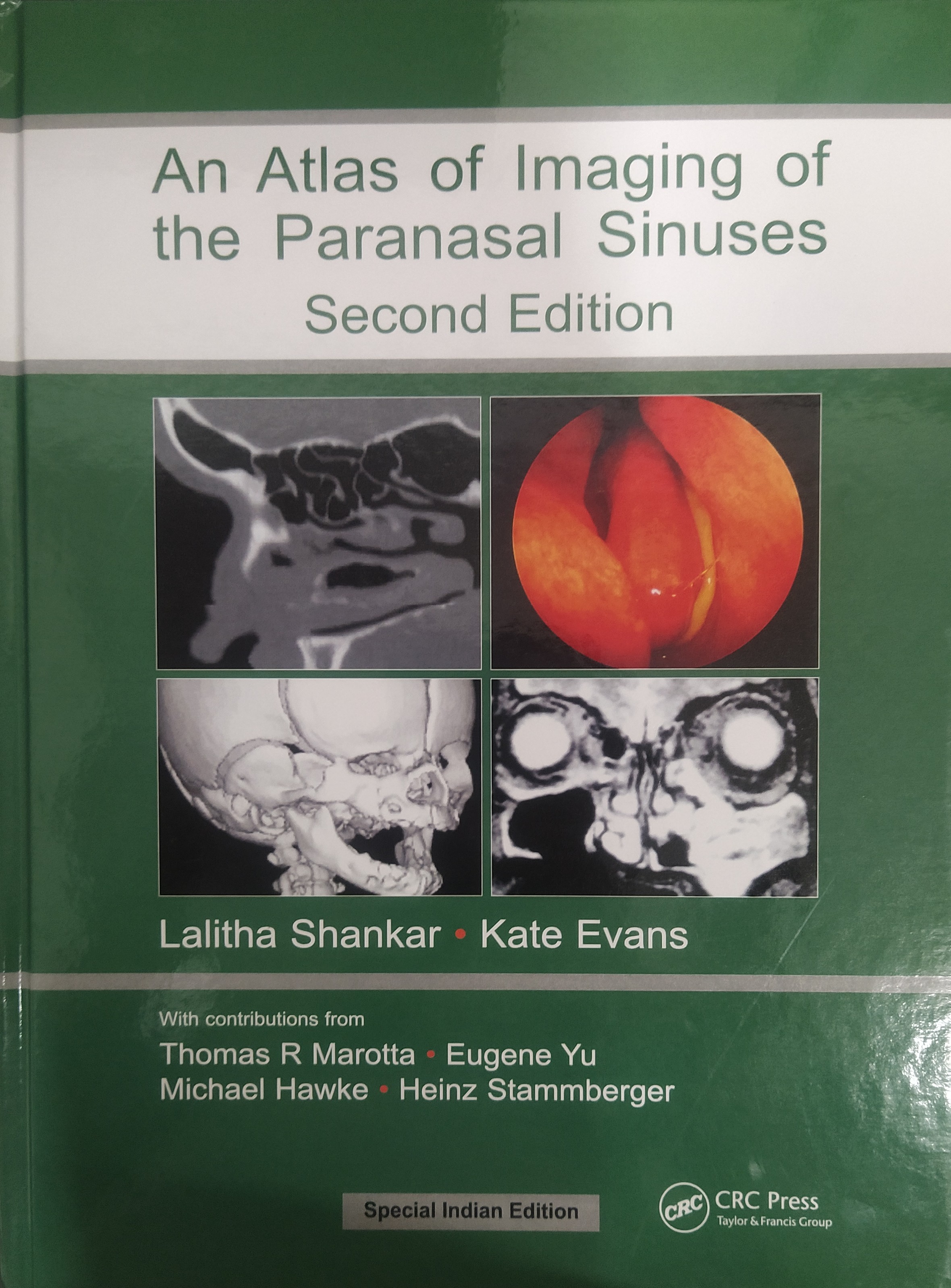 

exclusive-publishers/taylor-and-francis/atlas-of-imaging-of-the-paranasal-sinuses-9781032518763
