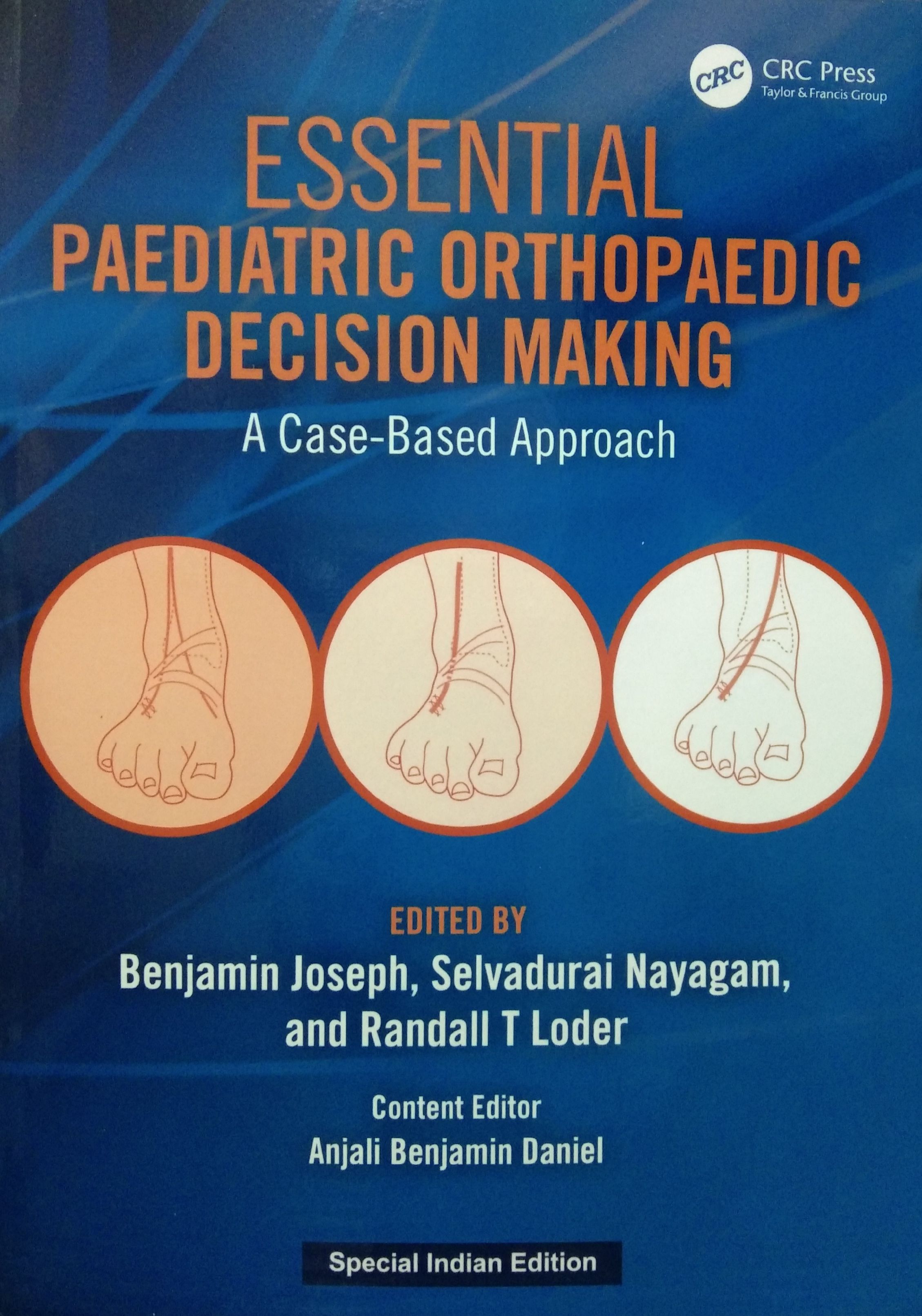 

exclusive-publishers/taylor-and-francis/essential-paediatric-orthopaedic-decision-making-9781032519043