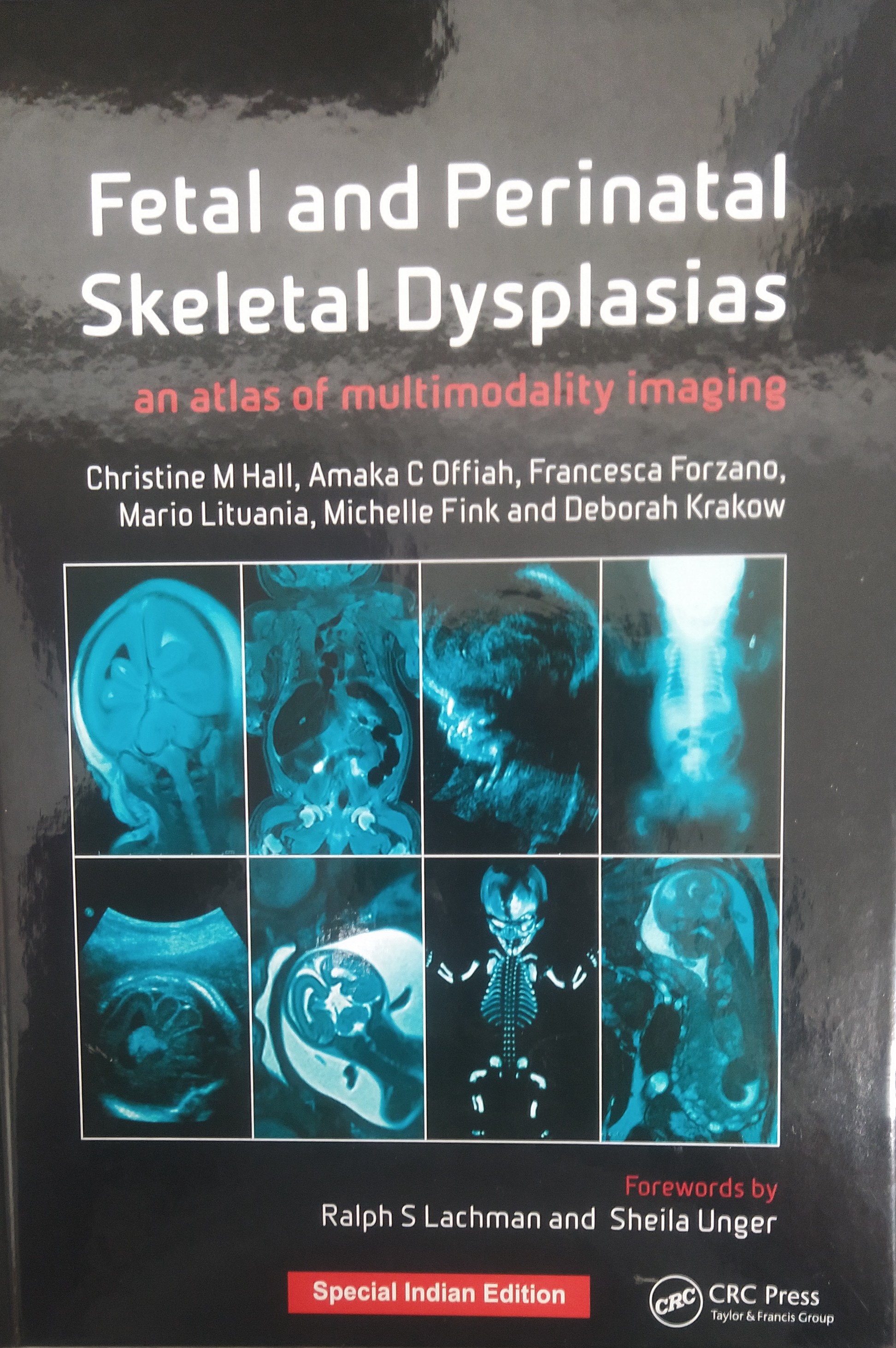 

exclusive-publishers/taylor-and-francis/fetal-and-perinatal-skeletal-dysplasias-9781032519081