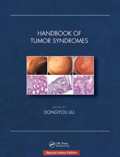 

exclusive-publishers/taylor-and-francis/handbook-of-tumor-syndromes-9781032519142