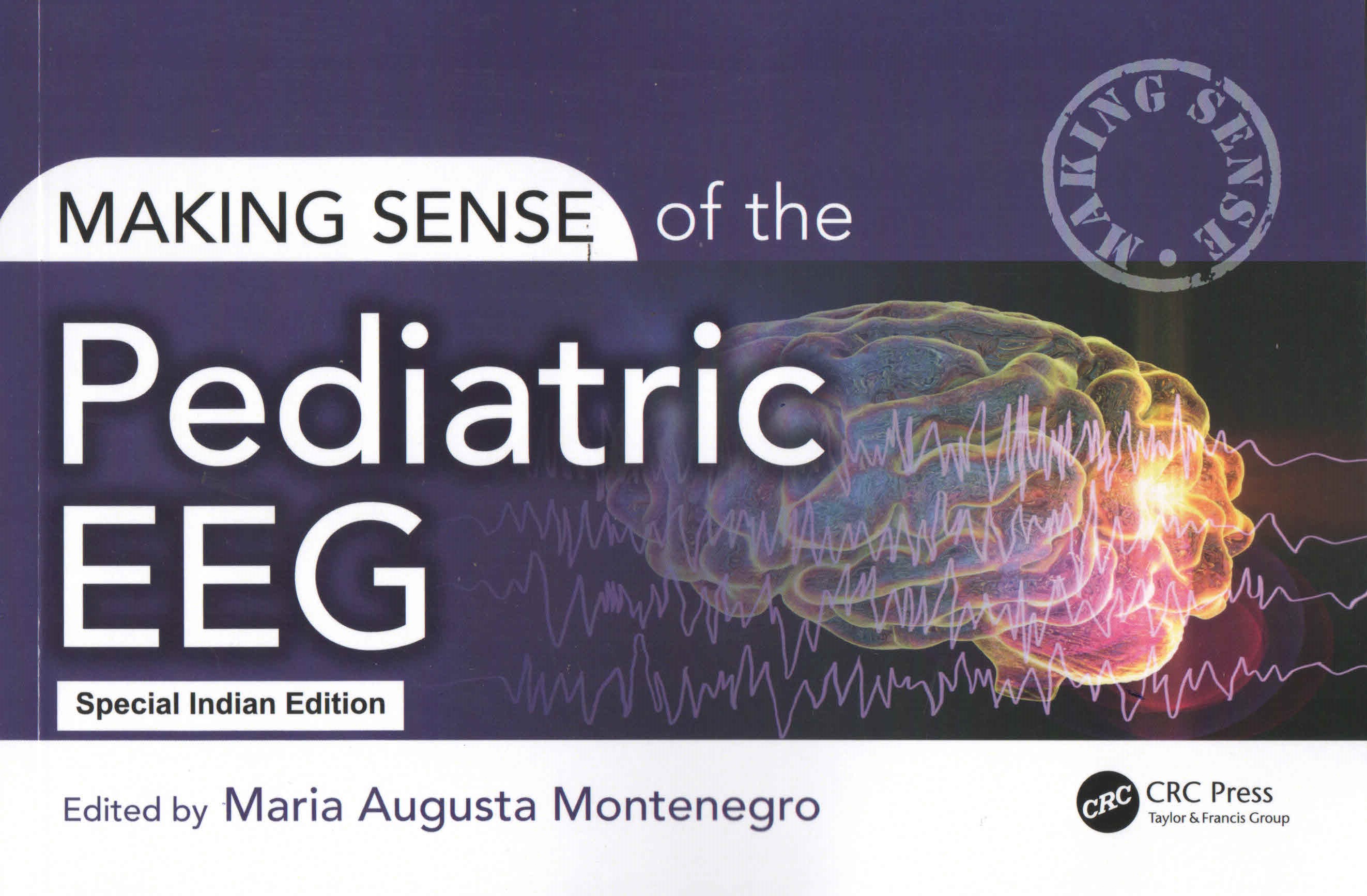 

exclusive-publishers/taylor-and-francis/making-sense-of-the-pediatric-eeg-9781032634074